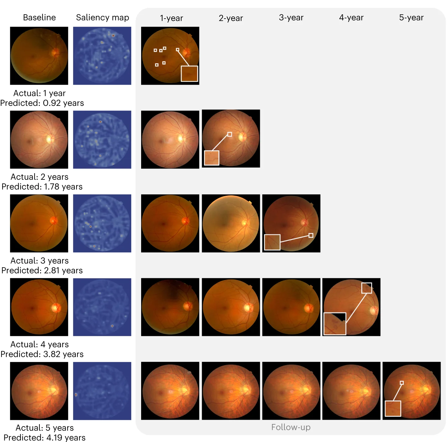 Open access visualization of Microscopy, Photo, Color Fundus Photographs, Attention Maps, Baseline