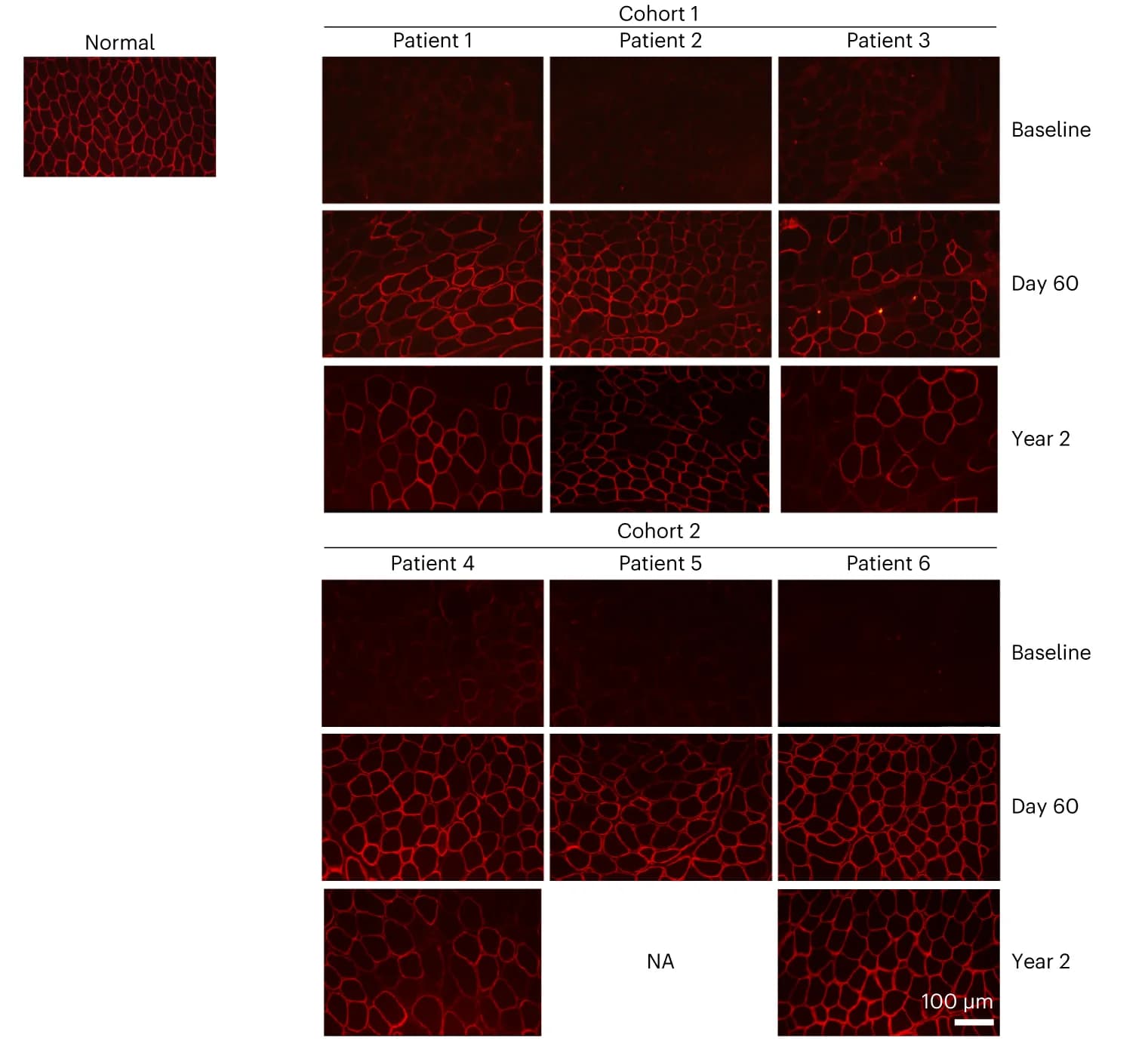 Open access visualization of Microscopy, Immunofluorescence, Muscle Sections, SGCB, Treatment