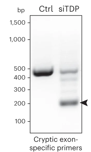 Open access visualization of Gel, Reverse Transcription PCR, Primers, HDGFL2, Cryptic Exon