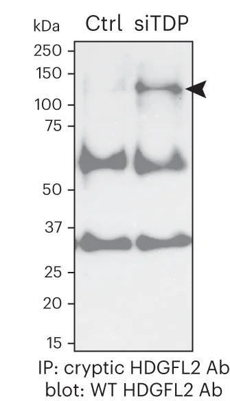 Open access visualization of Gel, IP Blot, Antibody, HDGFL2, IgG