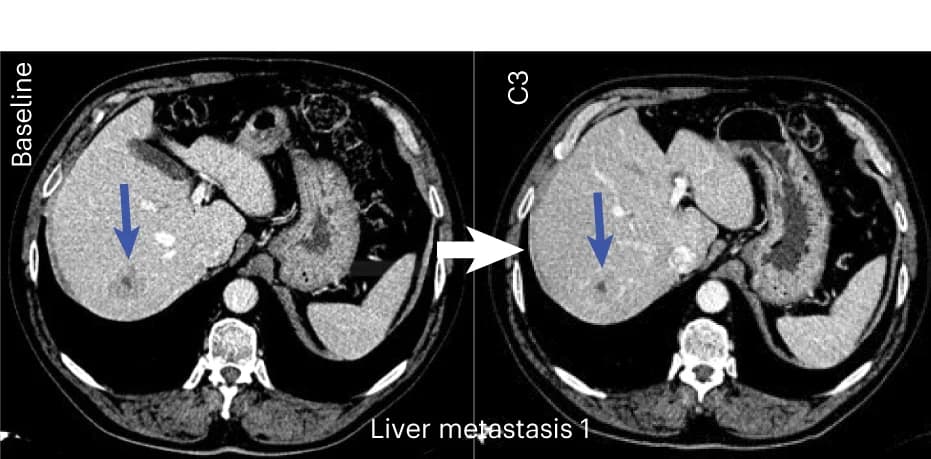 Open access visualization of Photo, Representative Images, Lesions