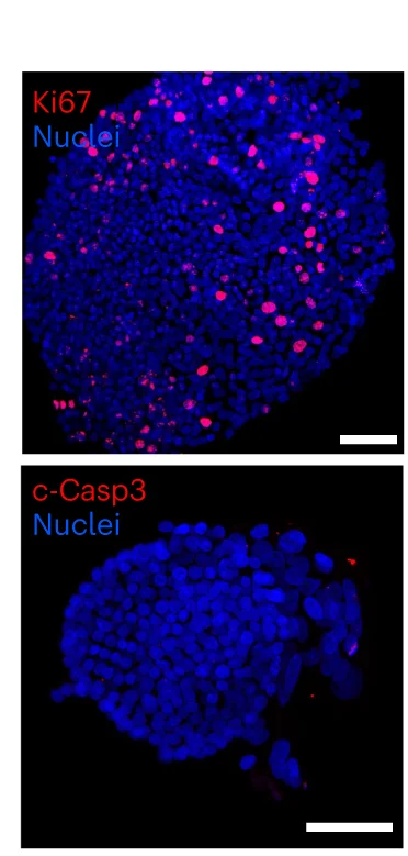 Open access visualization of Microscopy, Immunofluorescent Staining, Proliferative Marker Ki67, Apoptotic Cells, AFOs