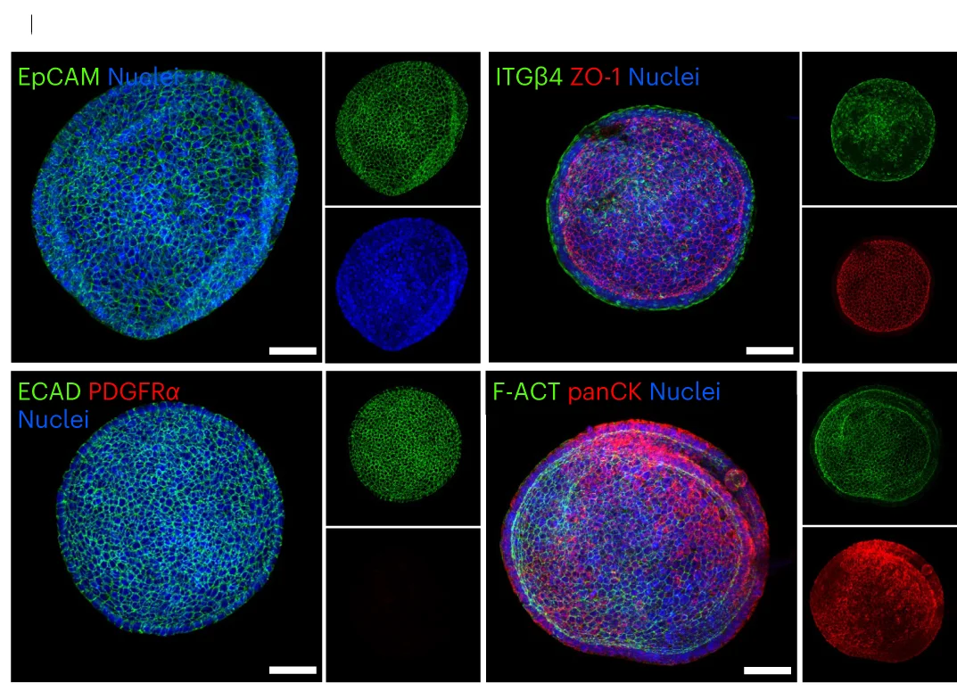 Open access visualization of Microscopy, Immunofluorescent Staining, AFO, Epithelial Markers, Mesenchymal Marker PDGFRɑ