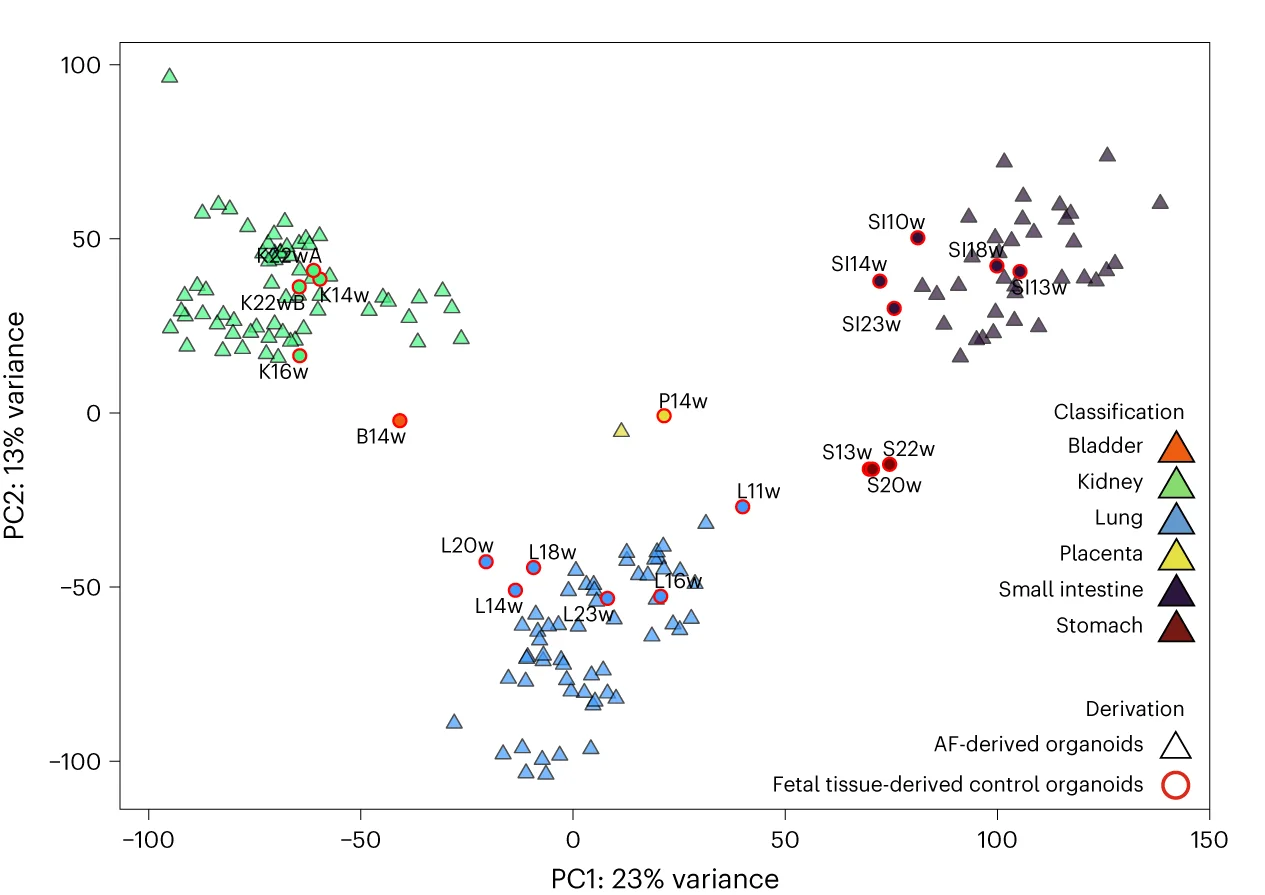 Open access visualization of Scatter Plot, PCA, Unsupervised PCA Plot, AFOs, Fetal Tissue-Derived Control Organoids
