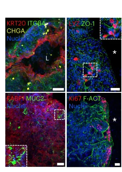 Open access visualization of Microscopy, SiAFO Rings, Enterocytes, Enteroendocrine Cells, LYZ-Positive Cells