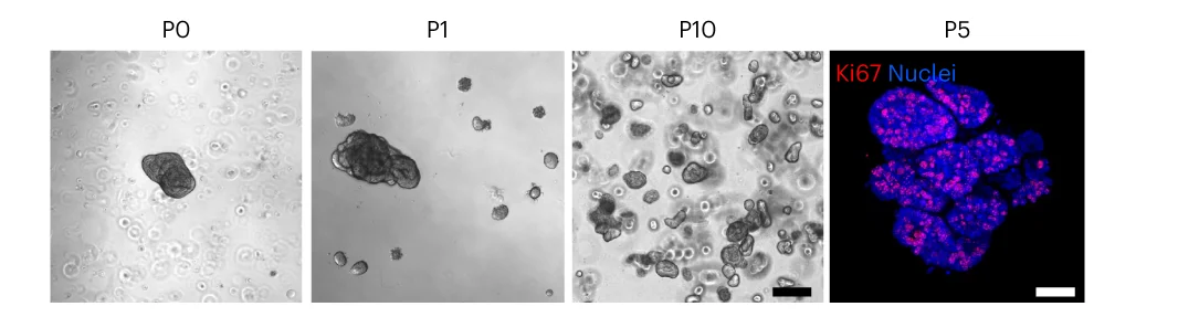Open access visualization of Microscopy, Phase-Contrast Images, KAFO Culture, Immunofluorescent Staining, Ki67
