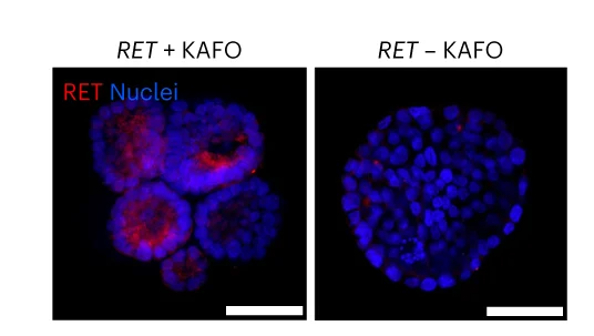 Open access visualization of Microscopy, Immunofluorescent Staining, RET Protein Localization, KAFOs