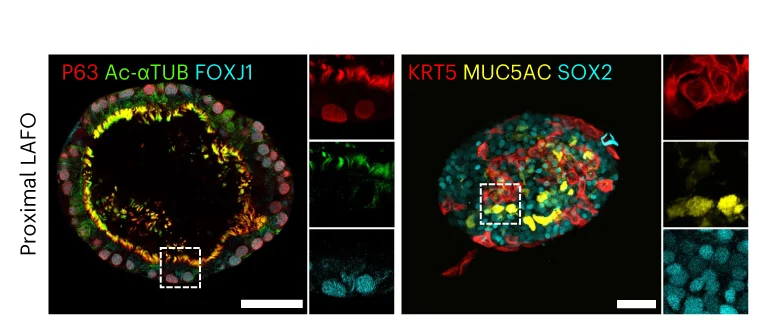 Open access visualization of Microscopy, Immunofluorescence Staining, Proximally Differentiated LAFOs, Ciliary Protein, Ac-αTUB