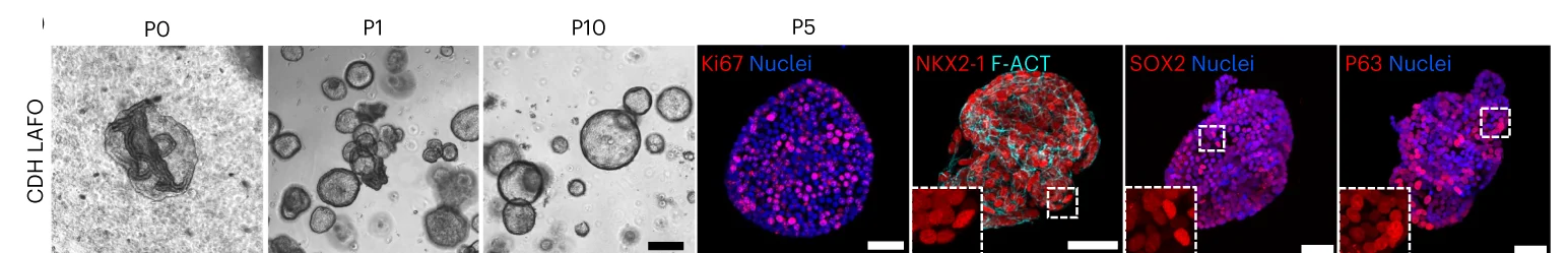 Open access visualization of Microscopy, Phase-contrast Images, CDH LAFOs, Immunofluorescence Staining, Proliferative Marker Ki67