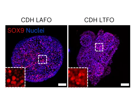 Open access visualization of Microscopy, Immunofluorescence Staining, SOX9, CDH LAFOs, CDH LTFOs
