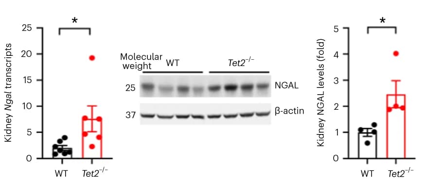 Open access visualization of Bar Plot, Error Bars, Gel, Kidney Ngal1 mRNA, Protein Expression