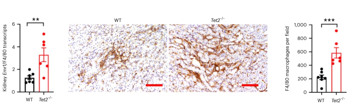 Open access visualization of Bar Plot, Error Bars, Microscopy, Kidney Emr1/F480 mRNA, F4/80 Macrophage Immunohistochemistry