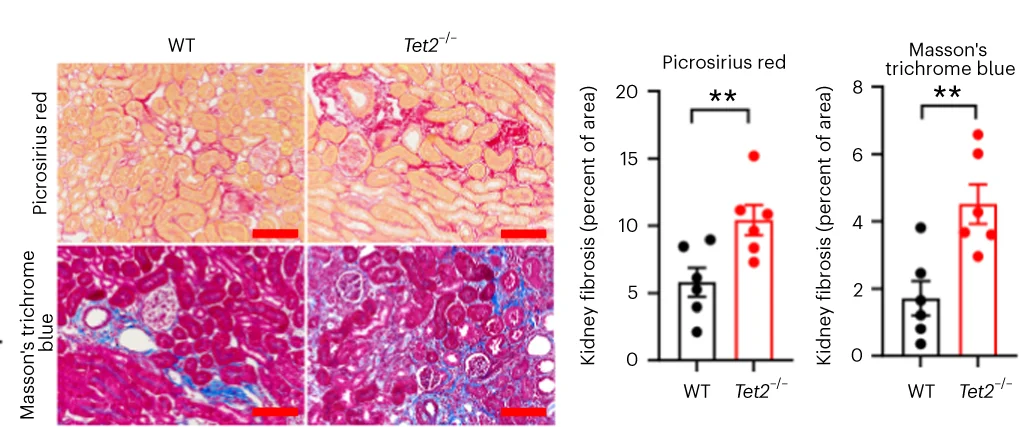 Open access visualization of Bar Plot, Error Bars, Microscopy, Kidney Histology, Masson Trichrome Blue Stain