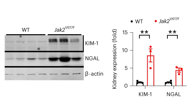 Open access visualization of Bar Plot, Error Bars, Photo, Gel, KIM-1 Protein Level