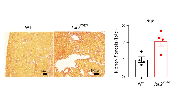 Open access visualization of Bar Plot, Error Bars, Microscopy, Kidney Histology, Picrosirius Red Stain