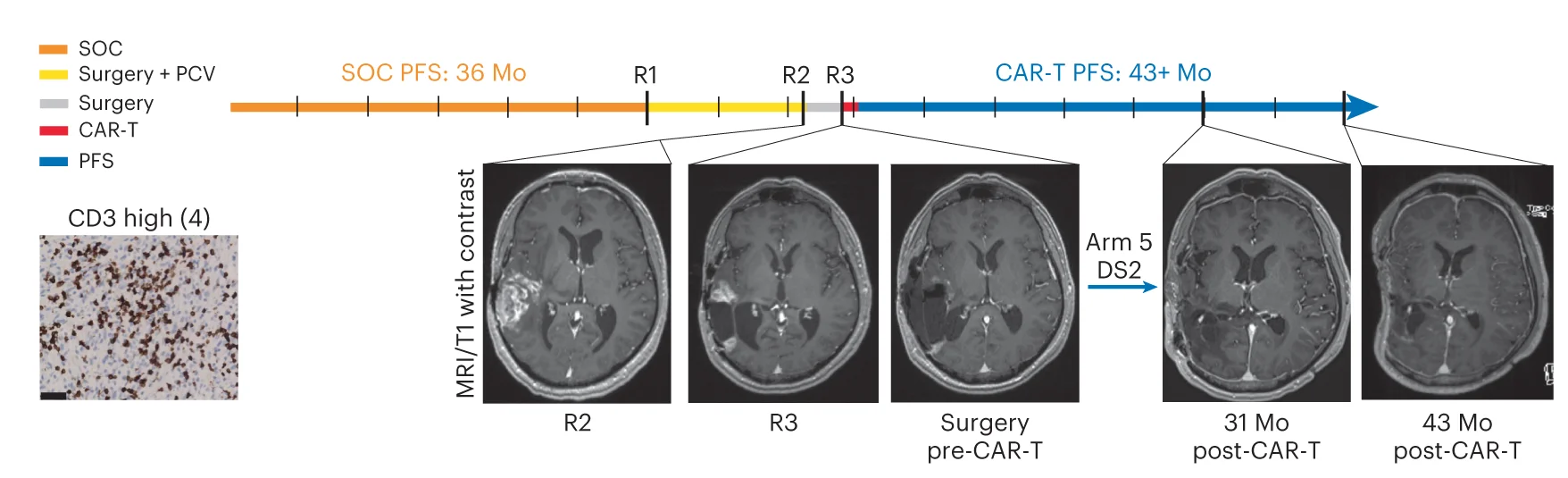 Open access visualization of Microscopy, Workflow, Photo, MRI, CD3