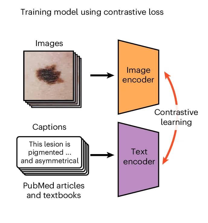 Open access visualization of Workflow, Flowchart, Training Procedure, Contrastive Learning, Dermatology Image