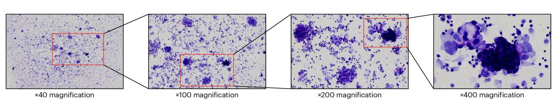 Open access visualization of Microscopy, Image Magnification, Diagnostic Process
