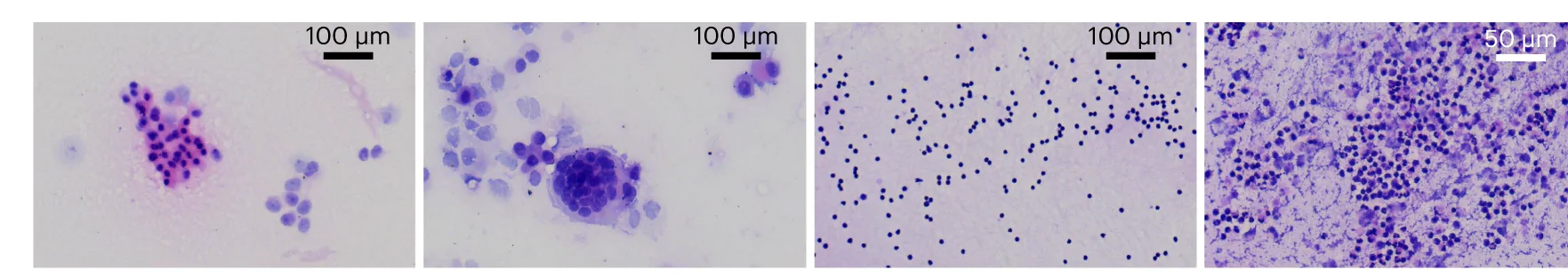 Open access visualization of Microscopy, Beaded Degenerated Histocytes, Female Reproductive System, Reactive Hyperplasia, Mesothelial Cells