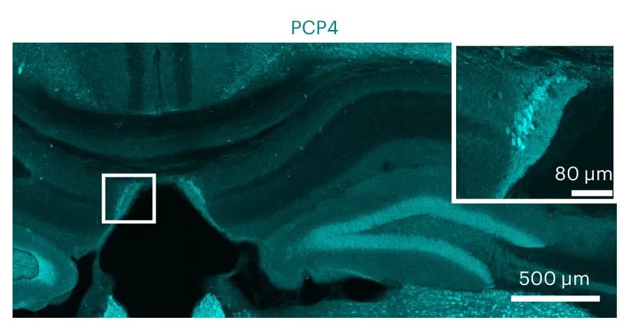 Open access visualization of Microscopy, Coronal Section, Wide-Field Image, PCP4 Expression, Non-Epileptic Mouse