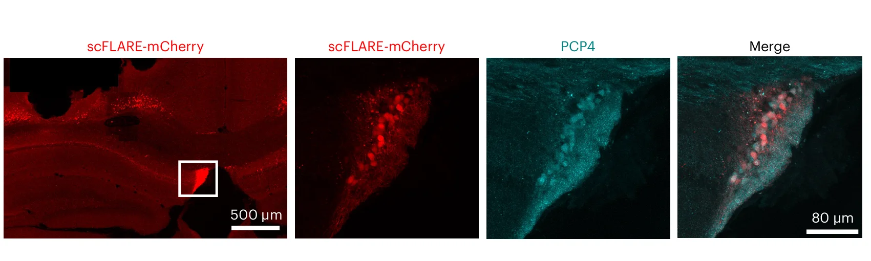 Open access visualization of Microscopy, Coronal Section, Wide-Field Image, FC Cells, mCherry