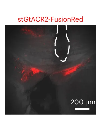 Open access visualization of Microscopy, Mouse Hippocampus, Epileptic Mouse, Optical Fiber, Kainic Acid Injection