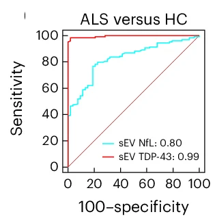 Open access visualization of Line Plot, ROC Curve, sEV TDP-43, Plasma NfL, ALS