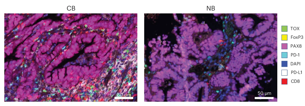 Open access visualization of Microscopy, Tumor Images, Clinical Benefit, No Benefit, Markers