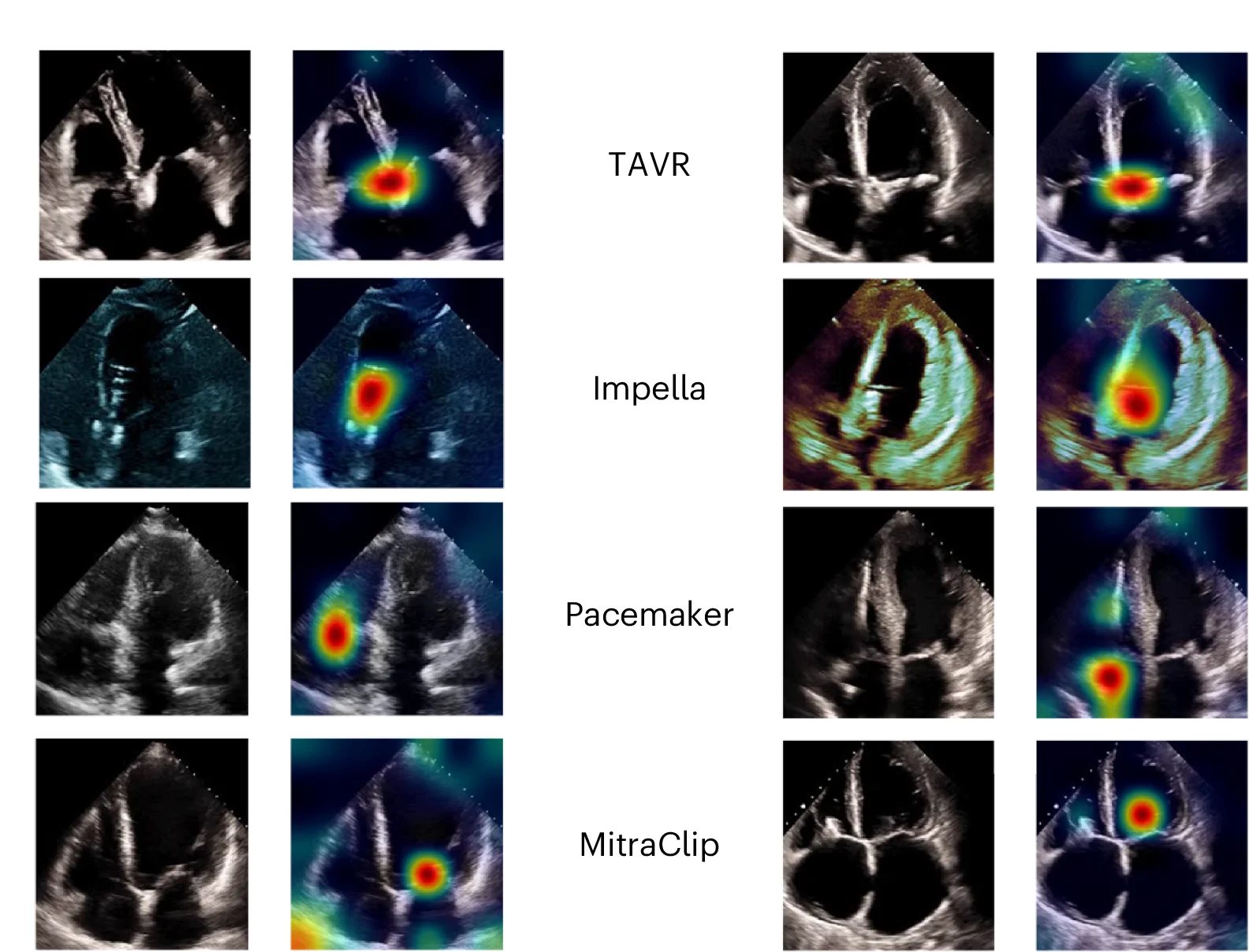 Open access visualization of Microscopy, Photo, Input Frames, PromptCAM, Intracardiac Devices