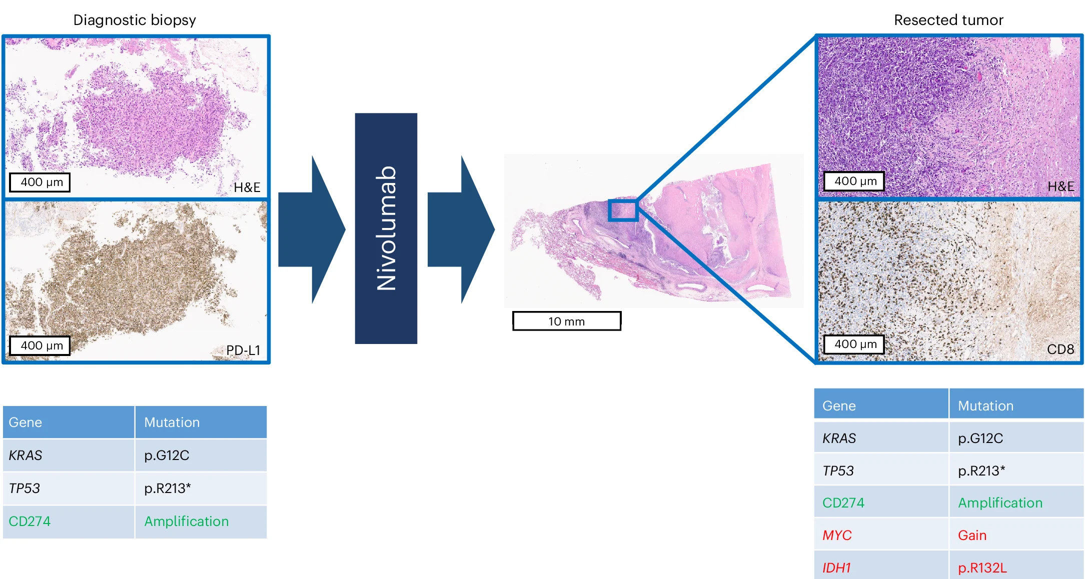 Open access visualization of Microscopy, Illustration, Table Image, Resistance Mechanisms, Tumor Specimens