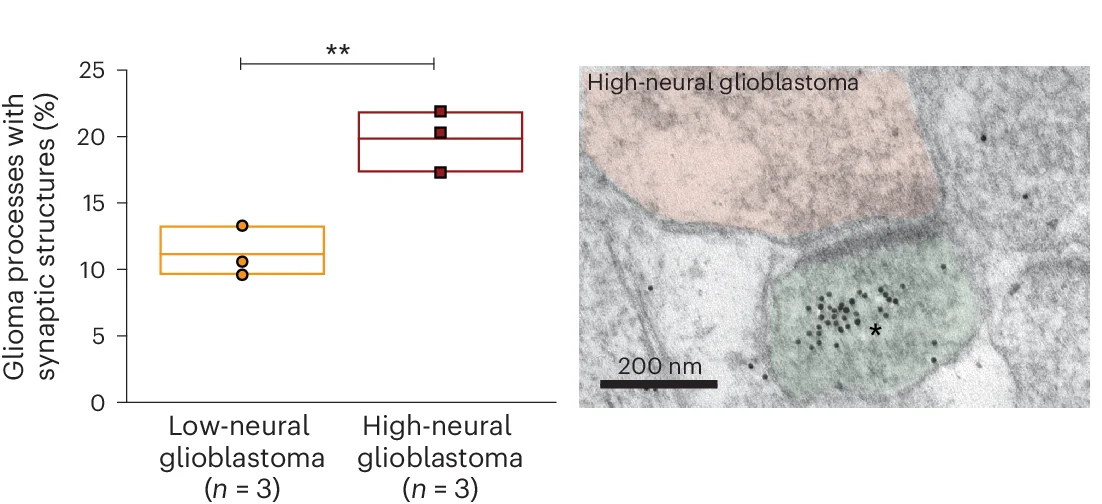 Open access visualization of Box Plot, Microscopy, Electron Microscopy, Red Fluorescent Protein, Glioblastoma Cells