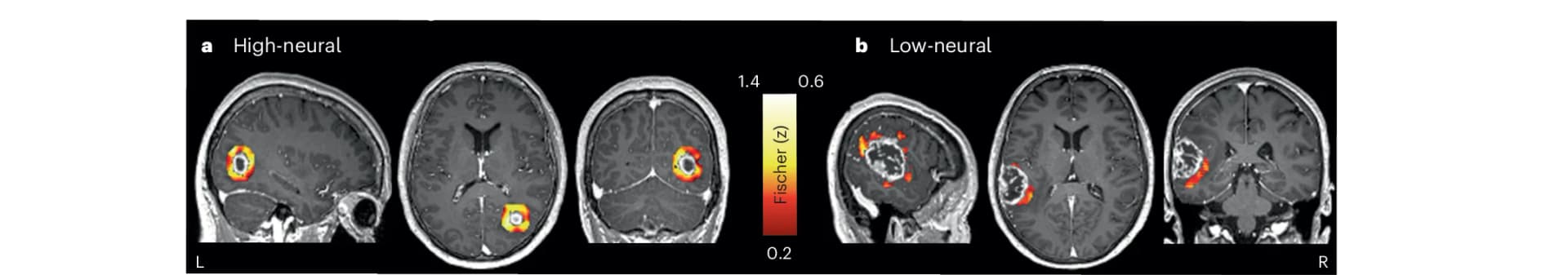 Open access visualization of Microscopy, Heatmap, Region of Interest, Functional Connectivity, Contrast-Enhancing Area