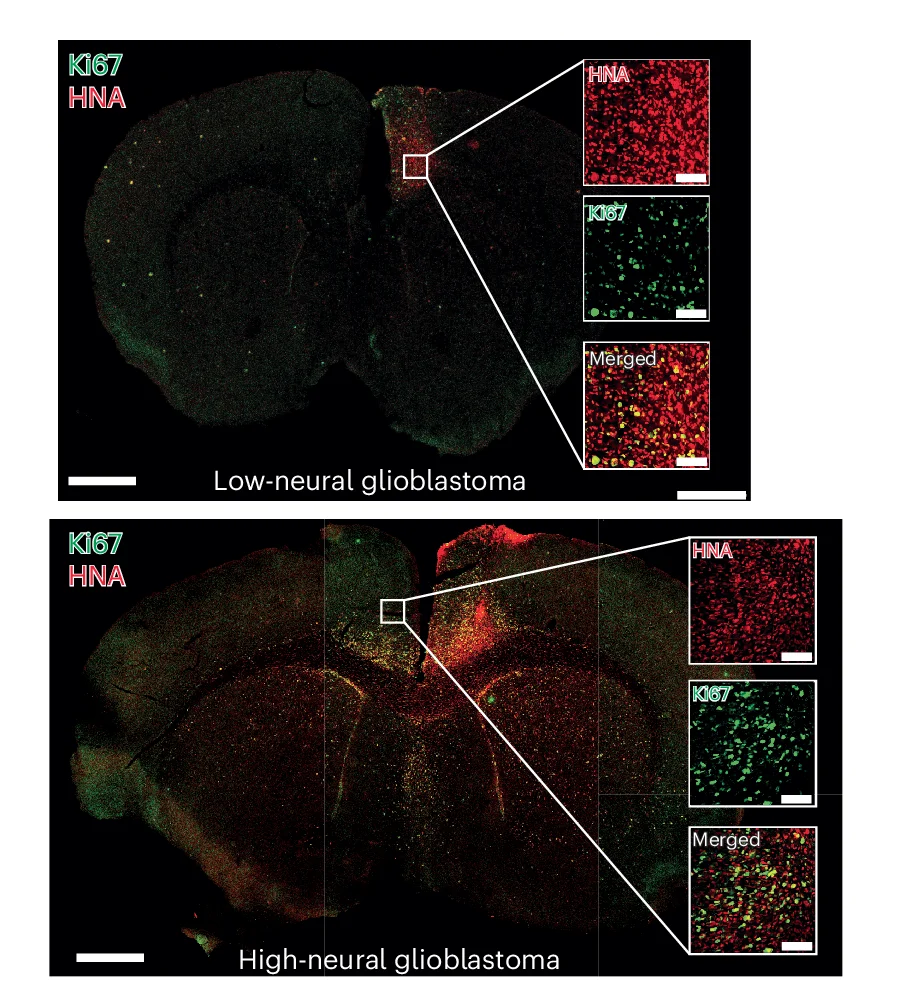 Open access visualization of Microscopy, Confocal Images, Proliferation Index, Xenografts, Human Nuclear Antigen