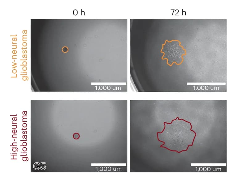 Open access visualization of Microscopy, Glioblastoma Cells, Migration Assay