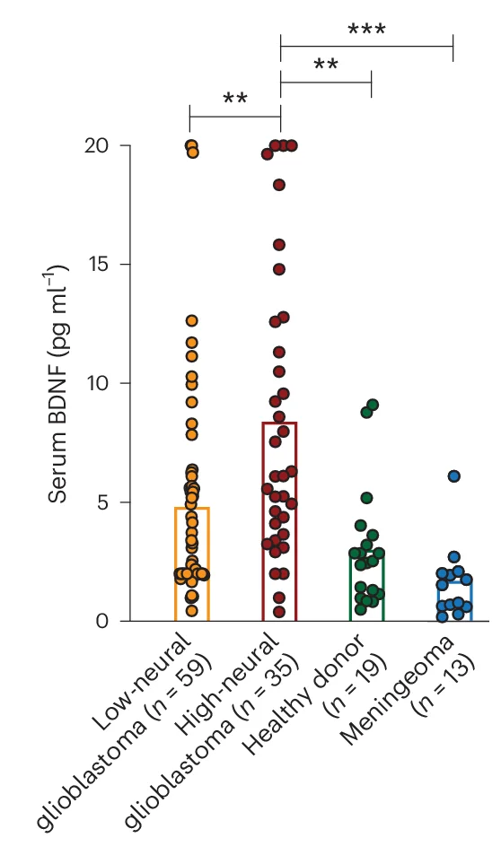 Open access visualization of Scatter Plot, Error Bars, Immunoassay, Serum BDNF Concentration, Glioblastoma