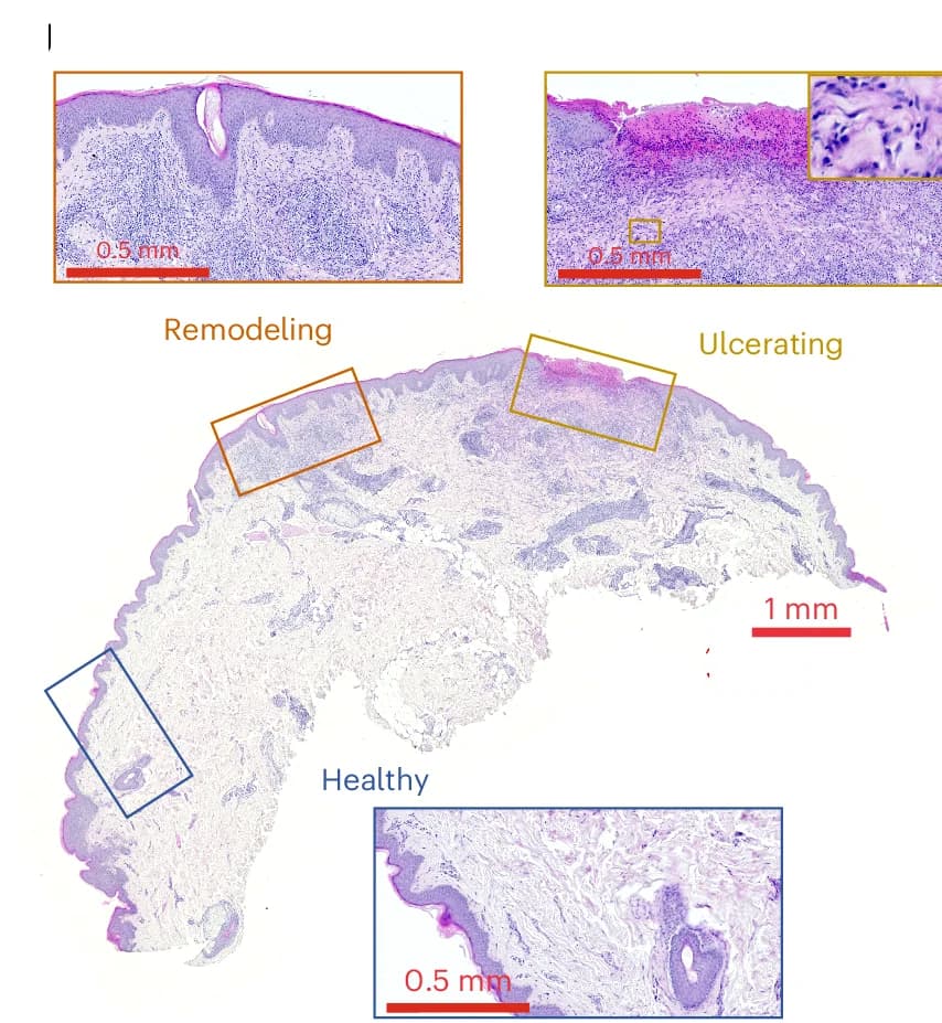 Open access visualization of Microscopy, H&E Staining, Biopsy Tissue, Normal Tissue, Bite Site