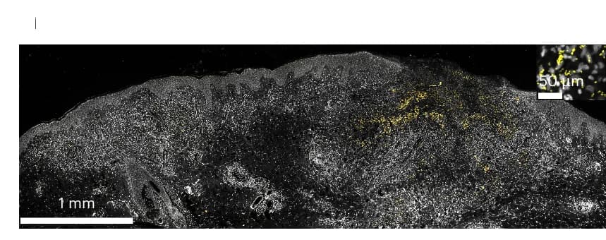 Open access visualization of Microscopy, IHC, Leishmania OPB, Nuclei, Remodeling