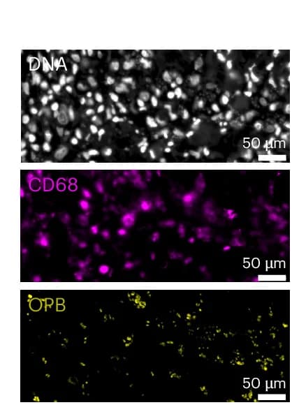 Open access visualization of Microscopy, IHC, OPB, CD68, Intracellular Parasitism