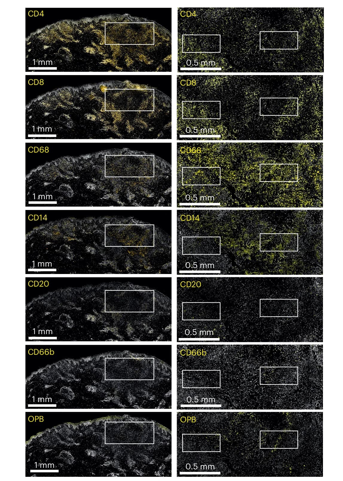 Open access visualization of Microscopy, Immunohistochemistry, CD4, CD8, CD68