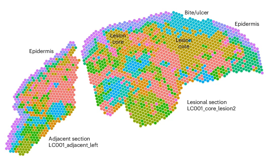 Open access visualization of Scatter Plot, Spots, Clusters, Spatial Locations, Lesion Sections