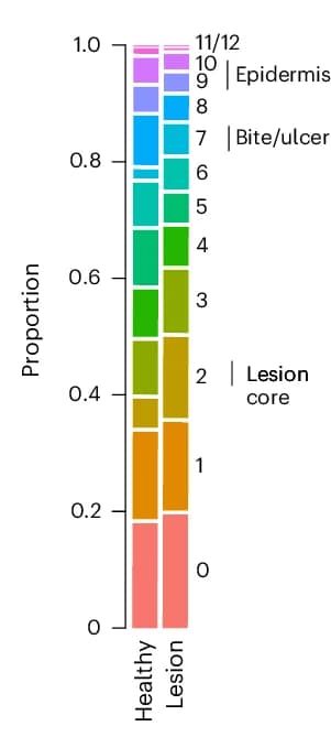 Open access visualization of Stacked Bar Plot, Spots, Clusters, Healthy Tissue, Lesion Tissue