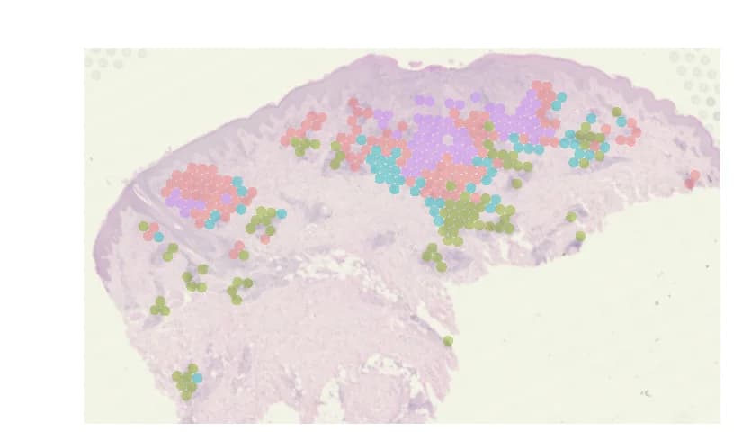 Open access visualization of Microscopy, Lesion Core, Subclusters