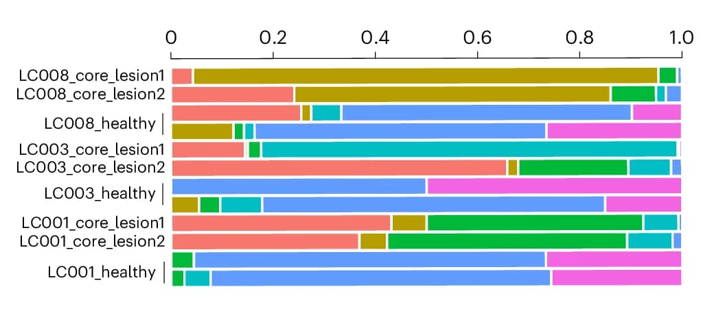 Open access visualization of Stacked Bar Plot, Spots, Healthy Tissue, Lesion Tissue, Section