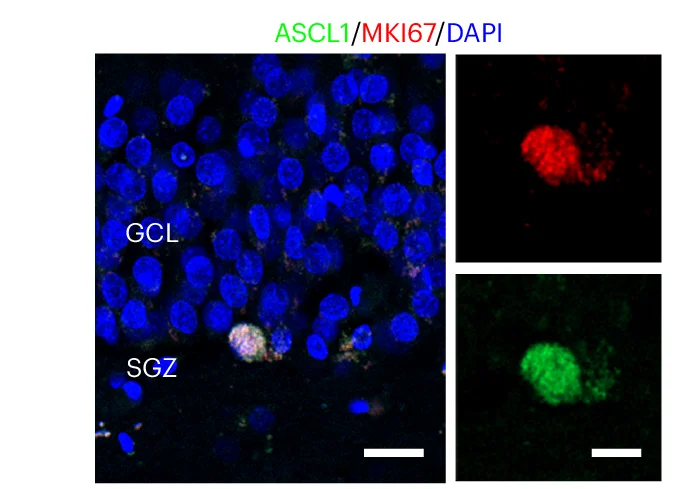 Open access visualization of Microscopy, Confocal Image, NPC Marker, ASCL1, MKI67