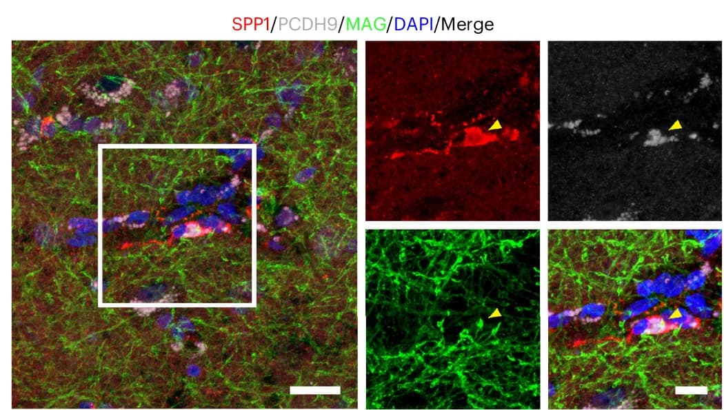 Open access visualization of Microscopy, Triple Immunostaining, SPP1, PCDH9, MAG