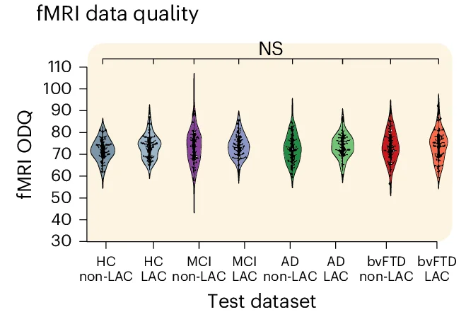 Open access visualization of Violin Plot, Violin Plots, Data Quality Metrics, fMRI, Healthy Controls