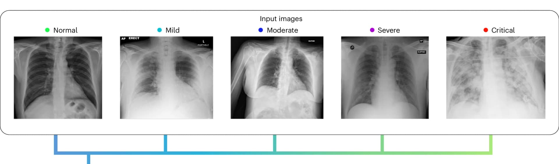 Open access visualization of Photo, Chest X-ray, BrixIA Dataset, Medical Imaging