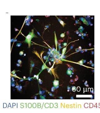 Open access visualization of Microscopy, IF Image, Glioblastoma, Patient Sample