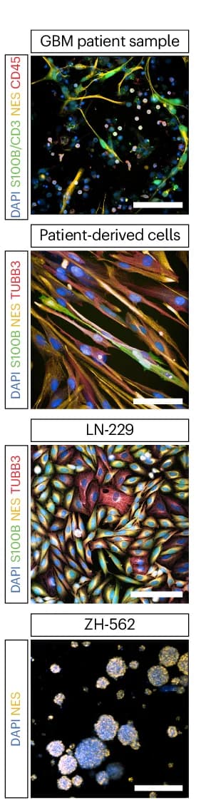 Open access visualization of Microscopy, Patient Sample, PDC Line, Glioblastoma Cell Line, Glioblastoma-Initiating Cell Line