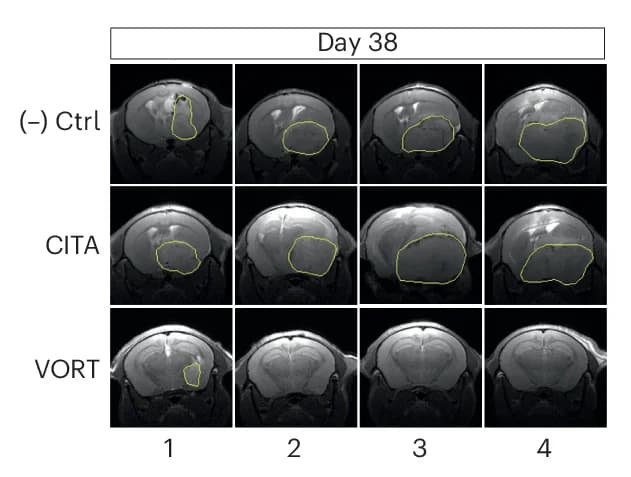 Open access visualization of Microscopy, MRI Images, Transplanted Mice, Tumor Implantation, Tumor Perimeters